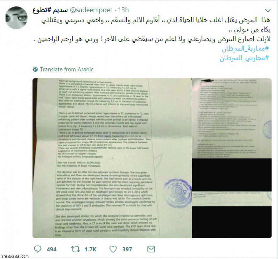 سديم: لم أتمالك دموعي بسبب تركي