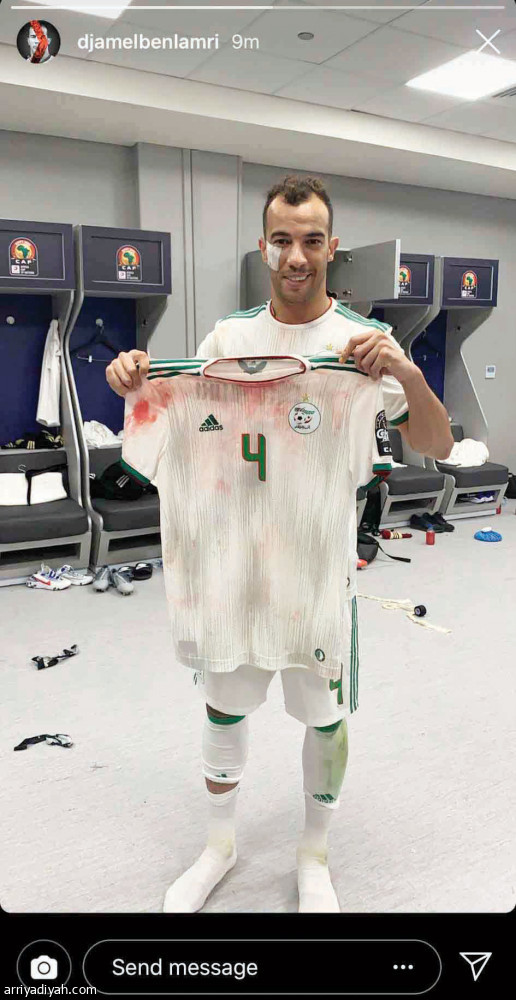 دماء الليث
تكتسح الأرقام في إنستجرام